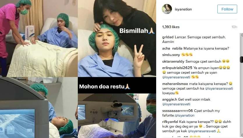 Isyana tengah jalani pengobatan mata © Instagram/isyanation_