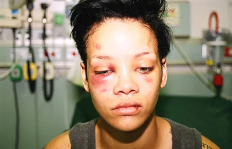 Rihanna mendapat perlakuan brutal Brown, 2009 @foto: imgace.com