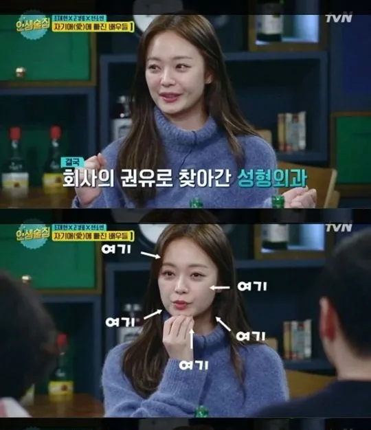 Jeon So Min mengaku dulu pernah ingin lakukan operasi plastik. © tvN