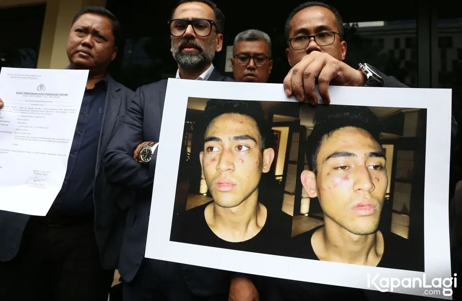 Jeremy Thomas mempertanyakan prosedur tes urin yang hendak dilaksanakan pada sang putra yang telah dipukuli © KapanLagi.com®/Agus Apriyanto