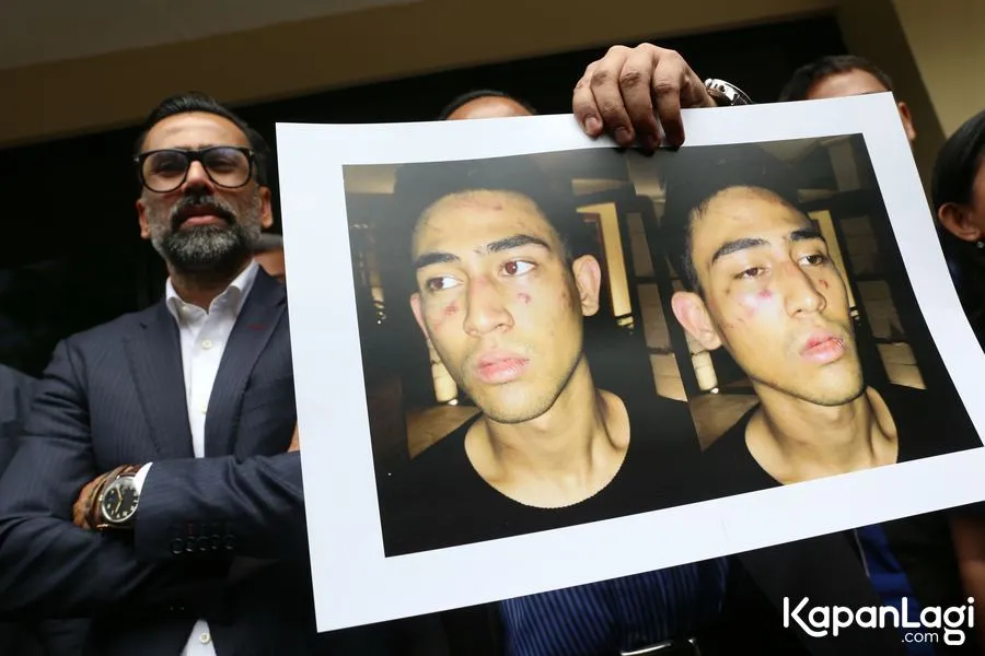 Dari keterangan Kombes Pol Argo Yuwono diketahui Axel Thomas jadi tersangka dalam kasus narkoba. ©KapanLagi.com/Agus Apriyanto