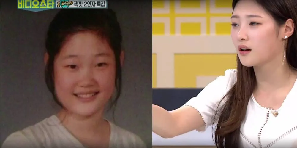 Chaeyeon, dulu dan kini © MBC