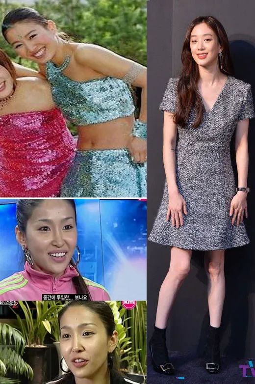 Jung Ryeo Won dulu dan kini. ©istimewa