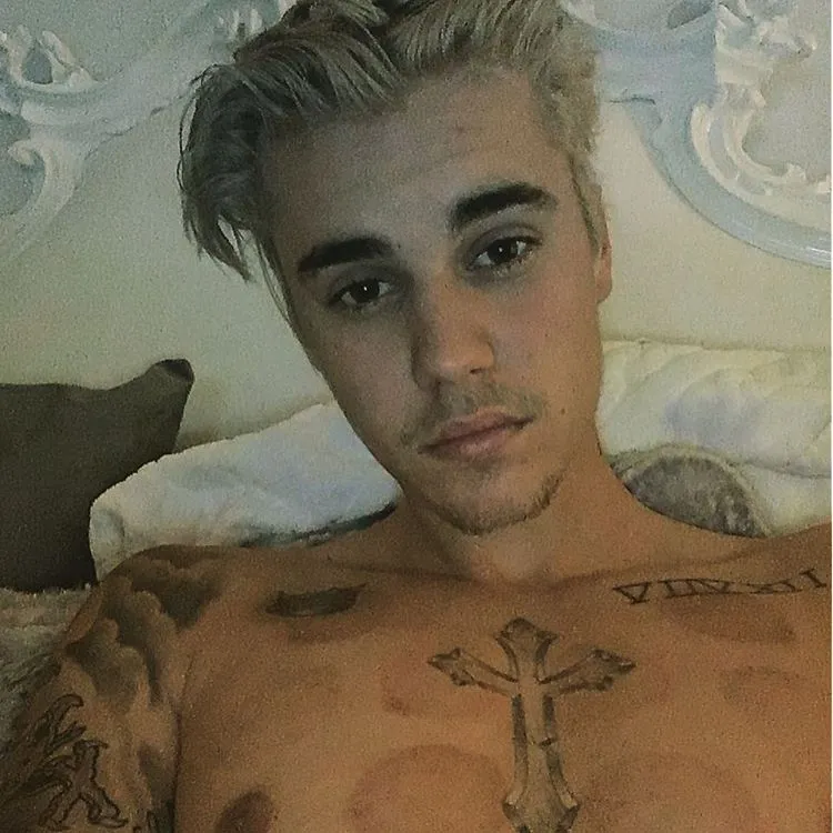 Justin Bieber selfie, pamerkan bekas bekam. ©instagram/justinbieber