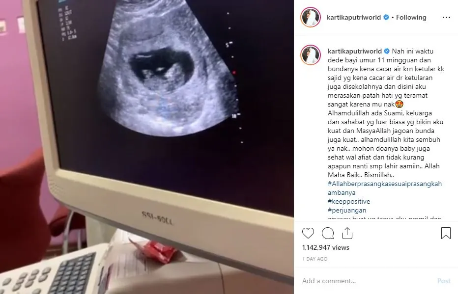 Postingan Kartika