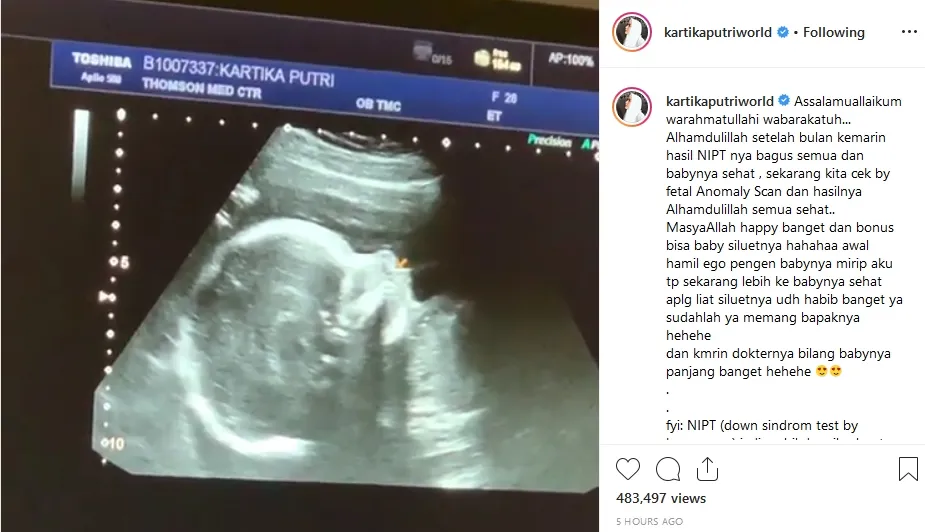 © instagram.com/kartikaputriworld