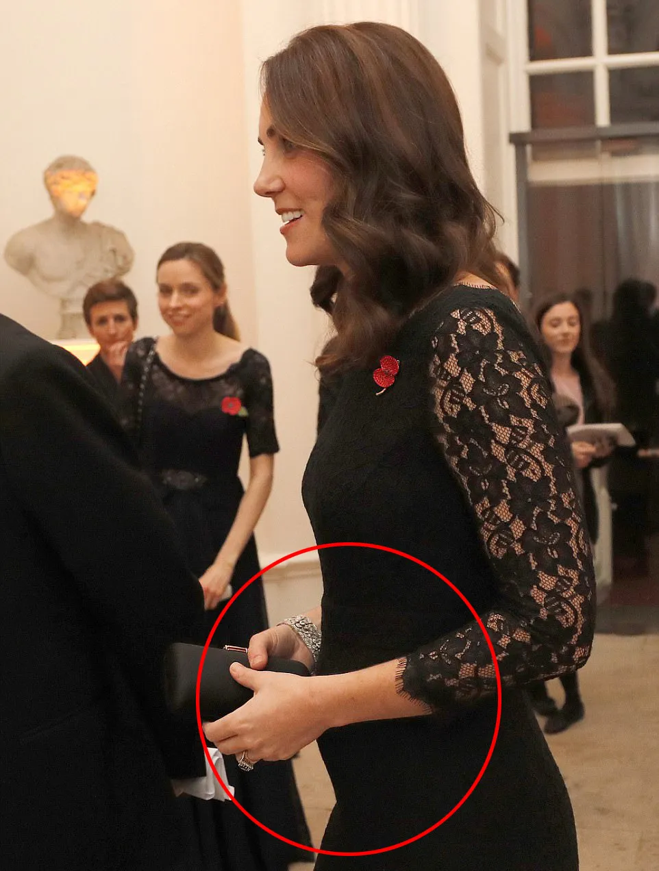 Kate makin buncit © dailymail.co.uk