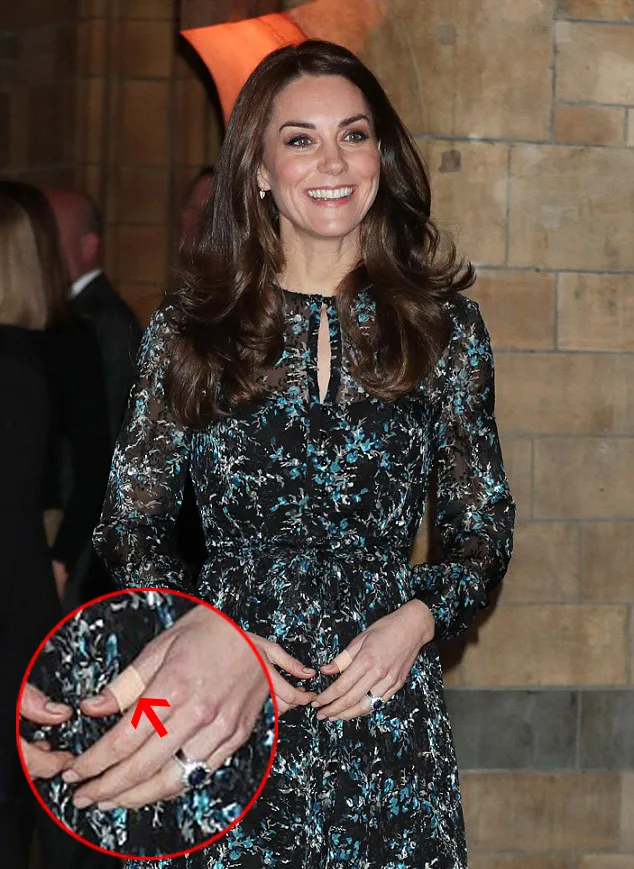 November lalu Kate juga pakai plester © dailymail.co.uk