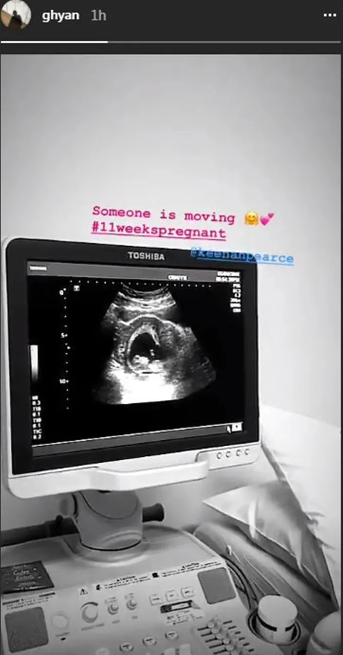 Gianni menunjukkan video USG miliknya. © Instagram/keenan.ghyan