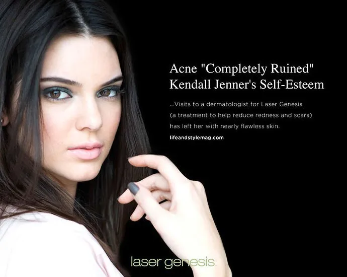 Iklan yang memakai nama dan foto Kendall tanpa izin © aceshowbiz.com/cutera