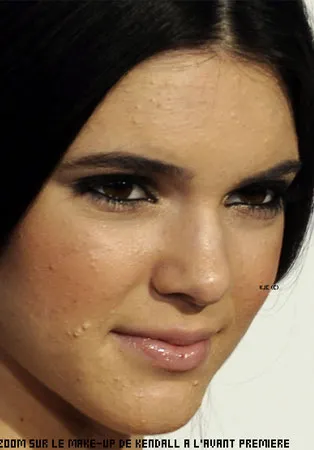Kendall Jenner dulu punya masalah jerawat © filmibeat.com