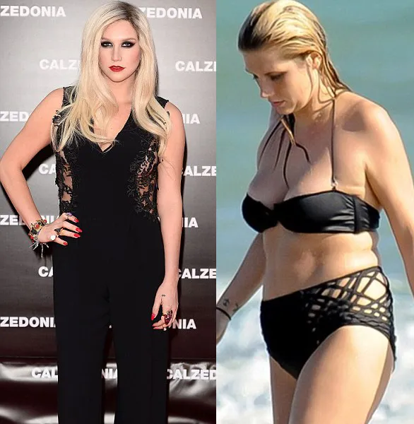 Kesha sekarang dan dulu. foto: dailymail.