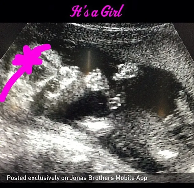 Foto Sonogram istri Kevin Jonas @ dailymail.co.uk