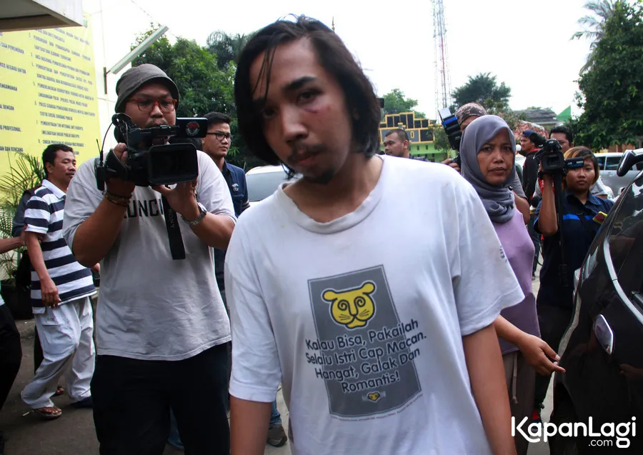 Kevin, pelapor tindak pemukulan Ganindra Bimo yang mengalami lebam di pelipisnya. ©KapanLagi.com/Muhammad Akrom Sukarya