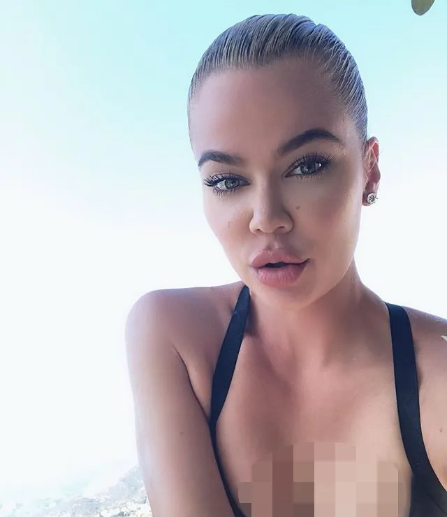 Bentuk Bibir Khloe Panen Hujatan
