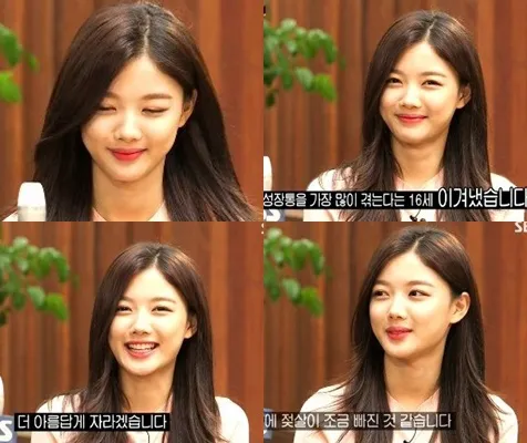 Kim Yoo Jung membantah rumor operasi plasti. ©newsen.com