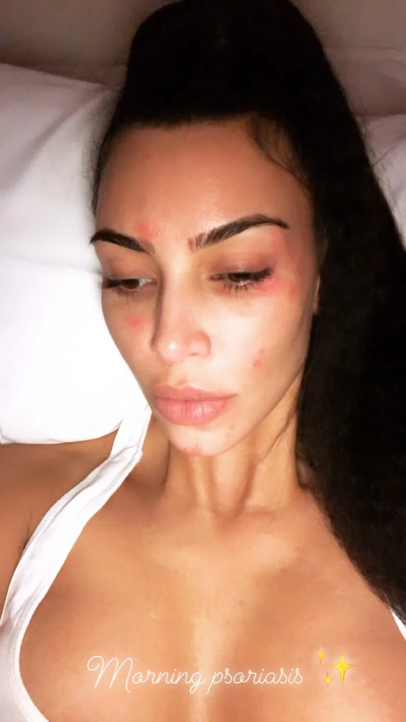 Kim pamerkan kondisi wajahnya © instagram.com/kimkardashian