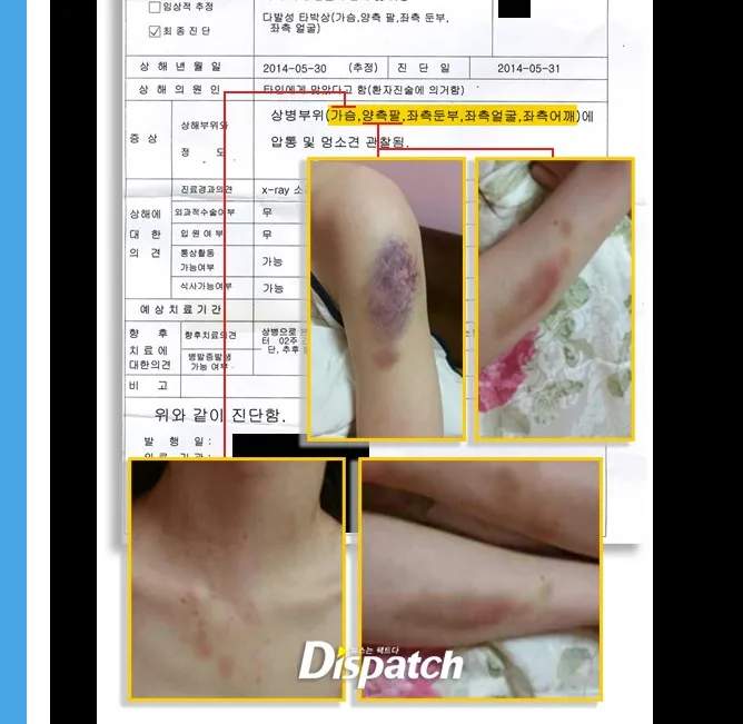 Kasus penganiayaan oleh Kim Hyun Joong September lalu. @Dispatch.co.kr