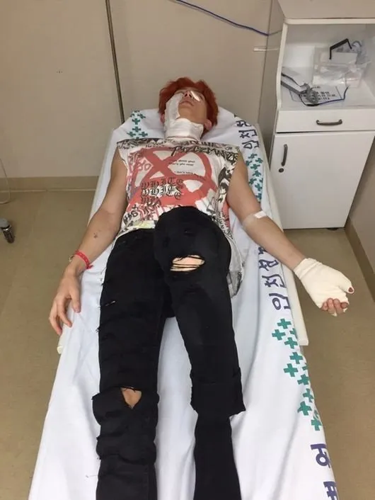 Kondisi Kiseop setelah mendapat perawatan, wajah dan tangan diperban. © koreaboo.com