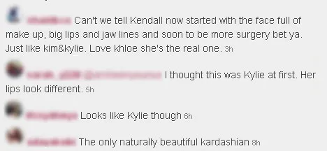 Bibir Kendall Jenner terlihat mirip Kylie © Instagram/Kendall Jenner