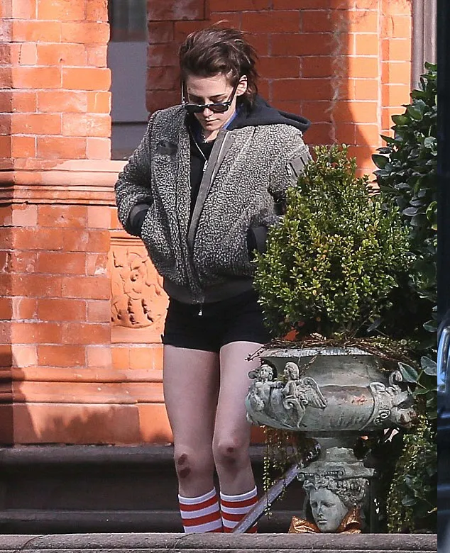 Kristen luka-luka di wajah dan lututnya © Fameflynet via dailymail.co.uk