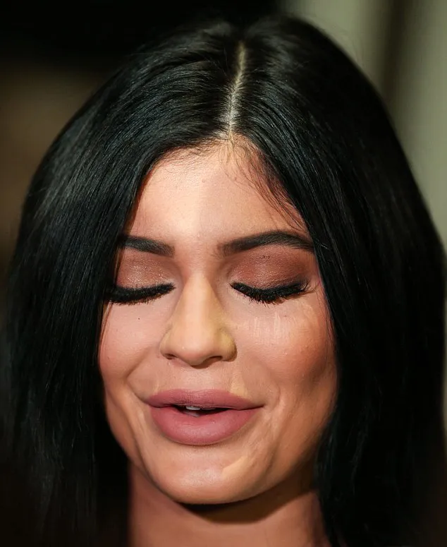 Wajah Kylie makin mulus dan berbeda © Splashnews.com