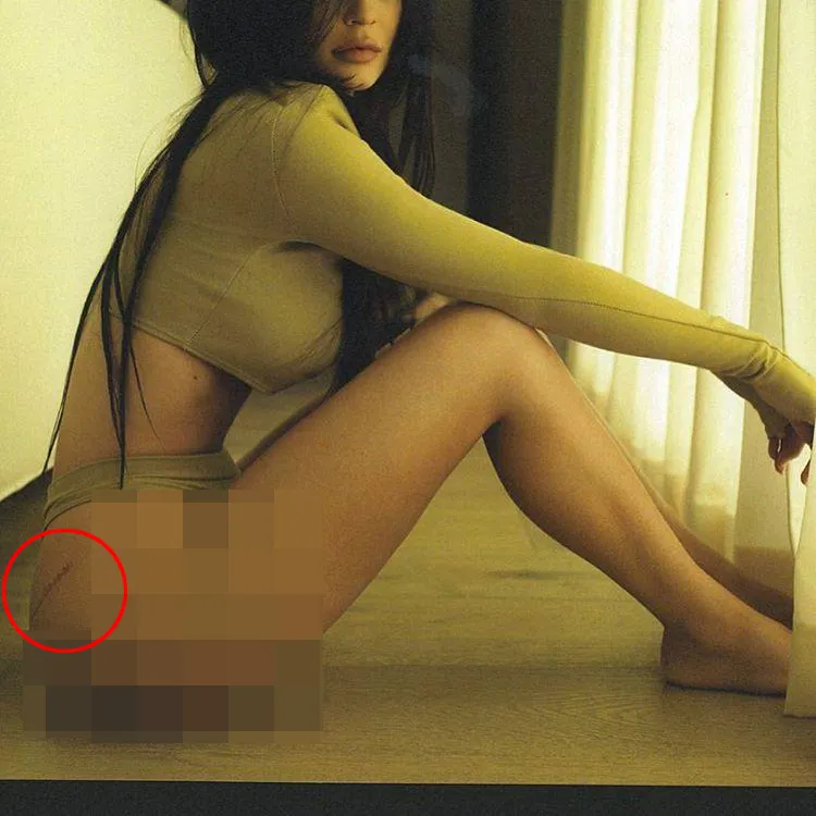 Netizen percaya jika ini adalah bekas luka Kylie usai pasang implan di bagian (maaf) pantatnya © instagram.com/kyliejenner
