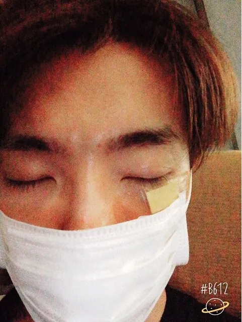Donghae Super Junior saat memperlihatkan lukanya pada fans. ©Instagram/Lee Donghae