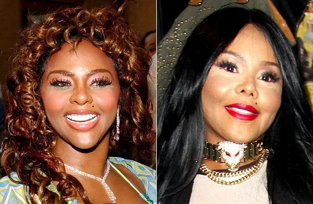 Lil Kim Before - After @ dailymail.co.uk