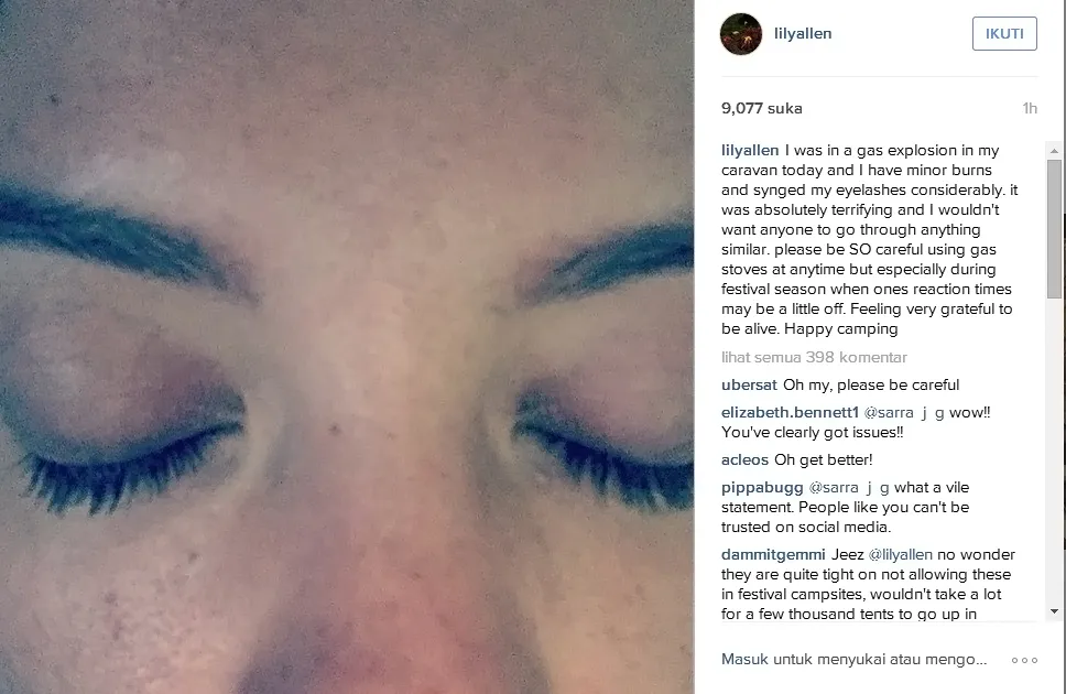 © Lily Allen/instagram
