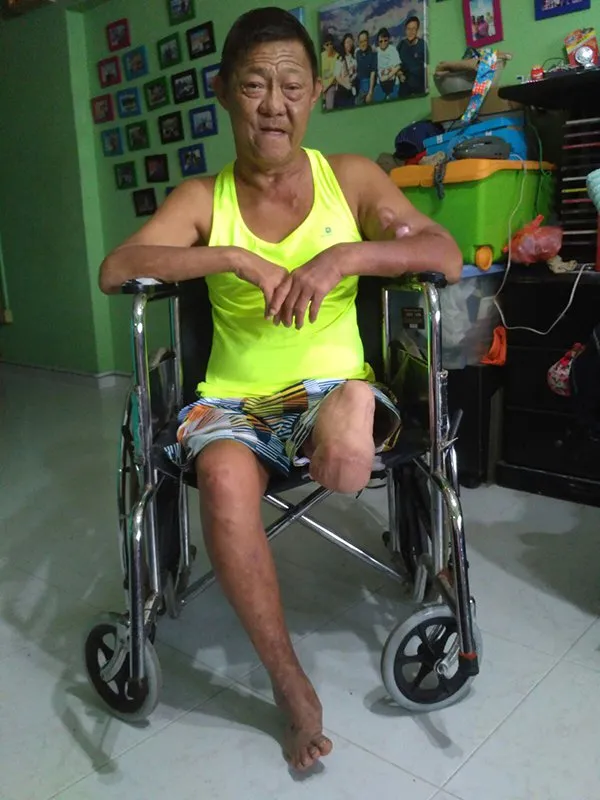 Lim, pria yang didiagnosis menderita diabetes di usia 21 tahun karena minum soda 6 kaleng sehari © World of Buzz