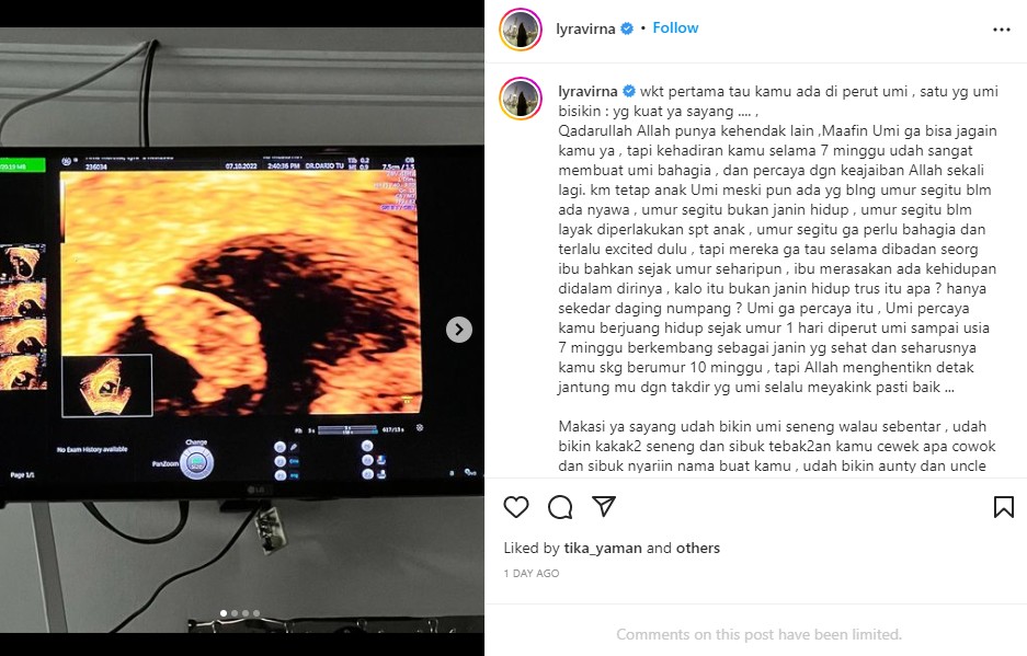 Setelah 7 Tahun, Lyra Virna Umumkan Kehamilan di Usia Tak Lagi Muda