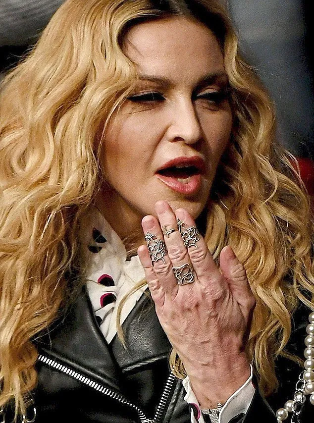 Beda jauh, coba perhatian wajah dan tangan Madonna via: dailymail.co.uk