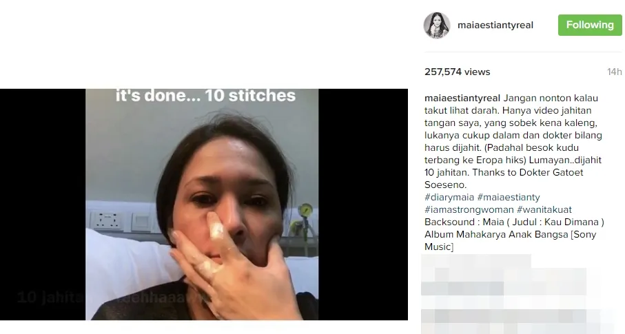 Tangan Maia harus dijahit setelah robek kena kaleng ©instagram/maiaestiantyreal