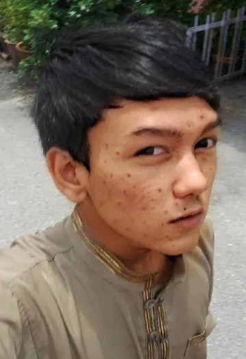 Wajah asli Miyyo Rizone sebelum menjalani prosedur operasi plastik © instagram.com/miyyo_rizone