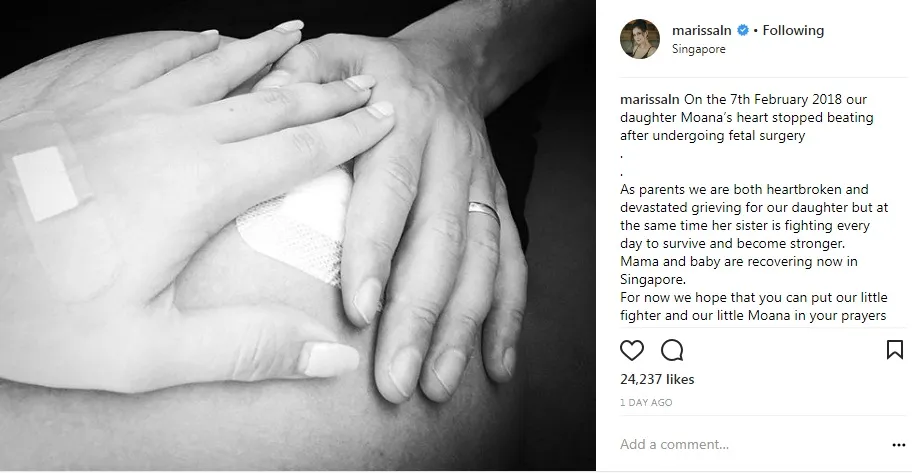 Marissa Nasution jalani fetal surgery untuk janin yang dikandungnya. cr: instagram.com/marissaln