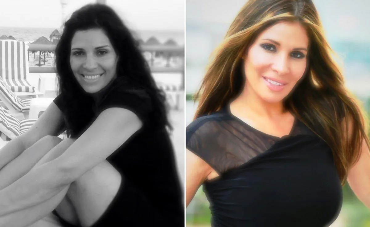 Claudia sebelum dan sesudah oplas © nydailynews.com