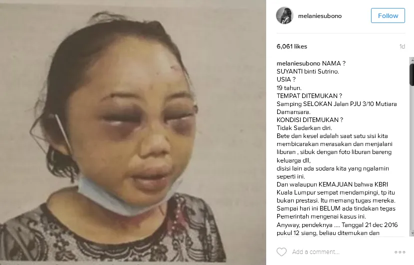 Foto korban dari aksi kekerasan di Malaysia © Instagram/melaniesubono