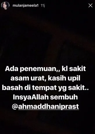 Mulan ungkap obat asam urat ala Dhani ©instagram/mulanjameela1