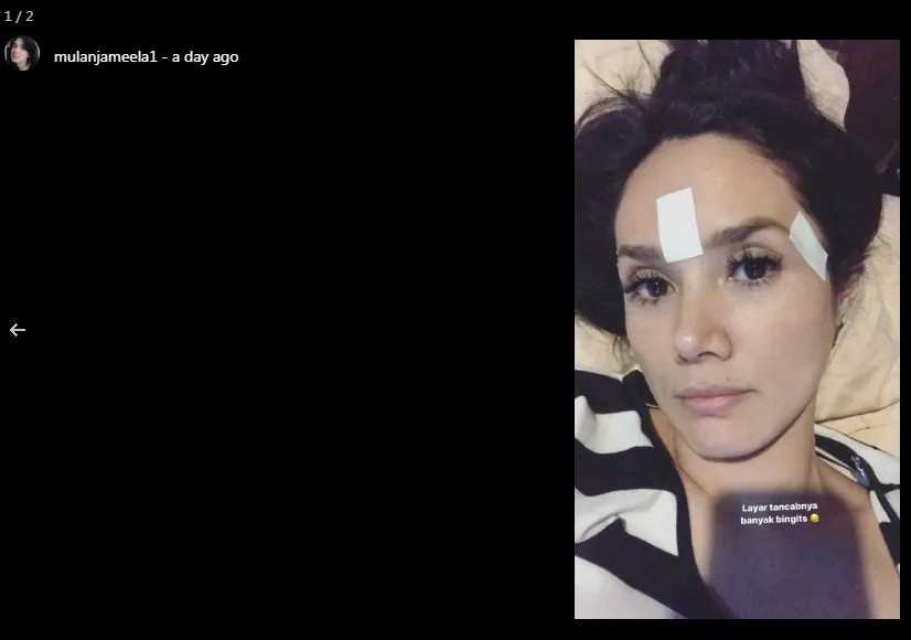 Mulan ketika memakai koyo, sederhana ©instagram/mulanjameela1