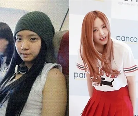 Na Eun A Pink yang dicurigai Netizen melakukan operasi plastik. ©koreaboo.com