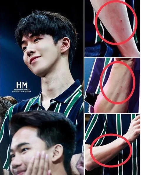 Ada luka di lengan Nam Joo Hyuk © Istimewa