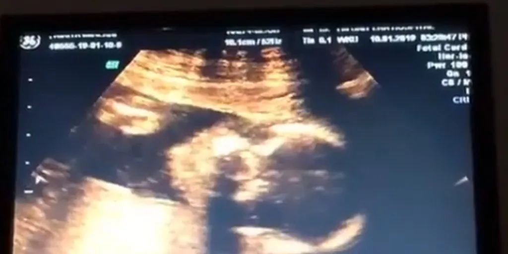 © KapanLagi.com/Bayu Herdianto