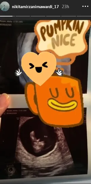 Nikita Mirzani ©instagram/Nikitamirzanimawardi_17