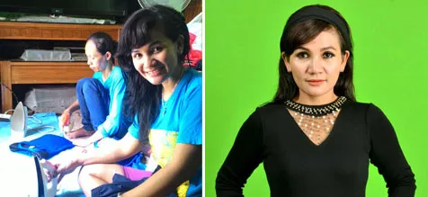 Foto Nina sebelum (kiri) dan sesudah melakukan operasi © istimewa