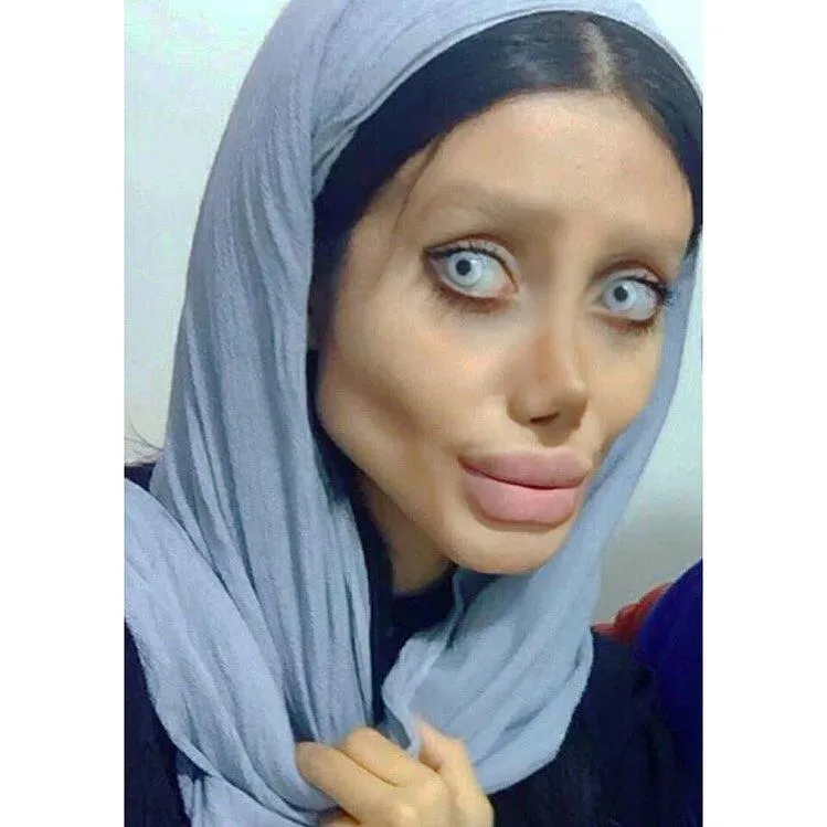 Sahar, wanita yang oplas demi mirip Angelina Jolie © instagram.com/sahartabar_official