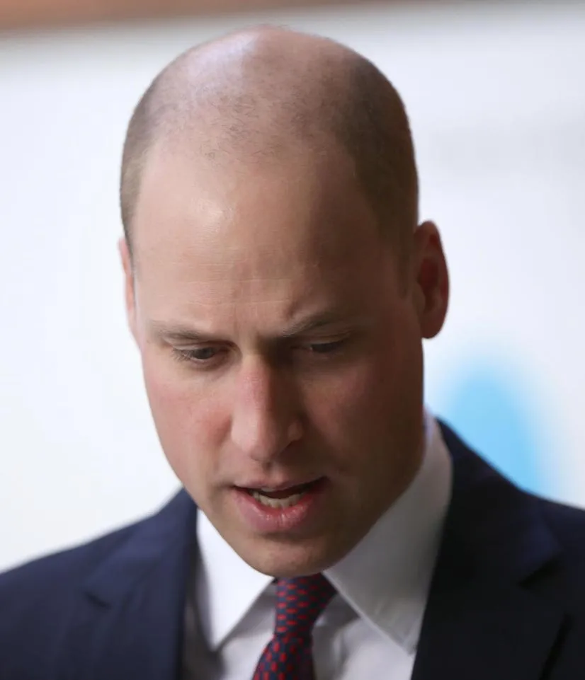 Pangeran William terlihat seperti botak. Credit: Mirror.co.uk