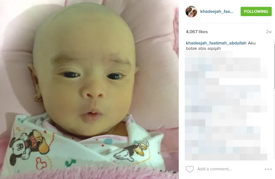 Wajah lucu Khadeejah dengan kepala gundul, nggemesin! ©instagram/khadeejah_faatimah_abadullah