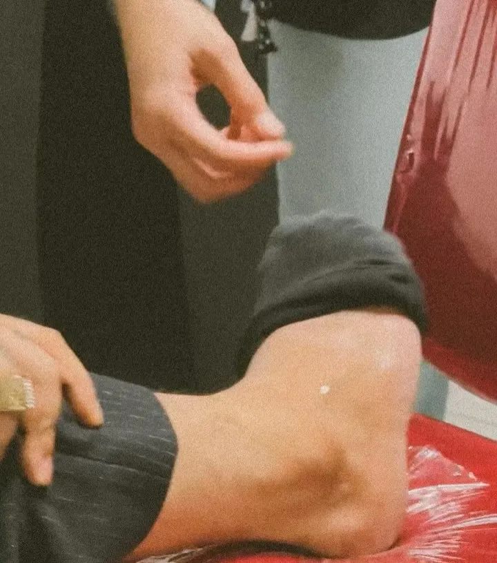 Onadio Leonardo Alami Insiden saat Manggung (Credit: Instagram/onadioleonardo_official)