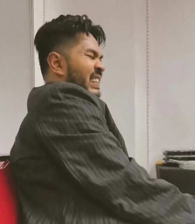 Onadio Leonardo Alami Insiden saat Manggung (Credit: Instagram/onadioleonardo_official)